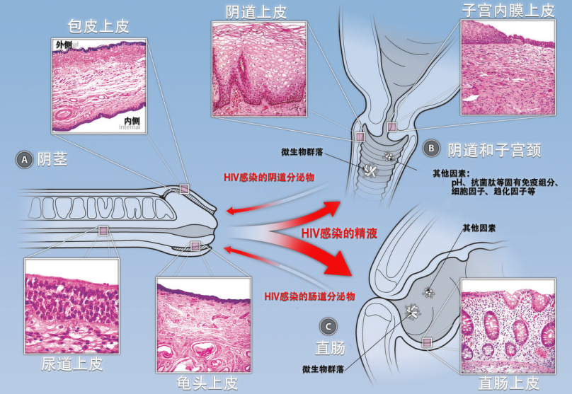 艾滋病毒藏身何处?安享性福要避免这些高危动作